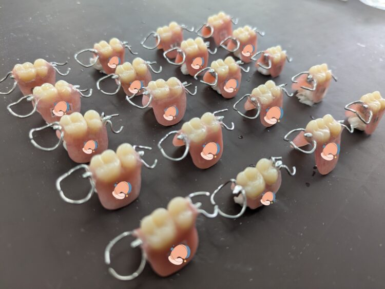 学生が挑戦した2本義歯の製作と臨床への一歩